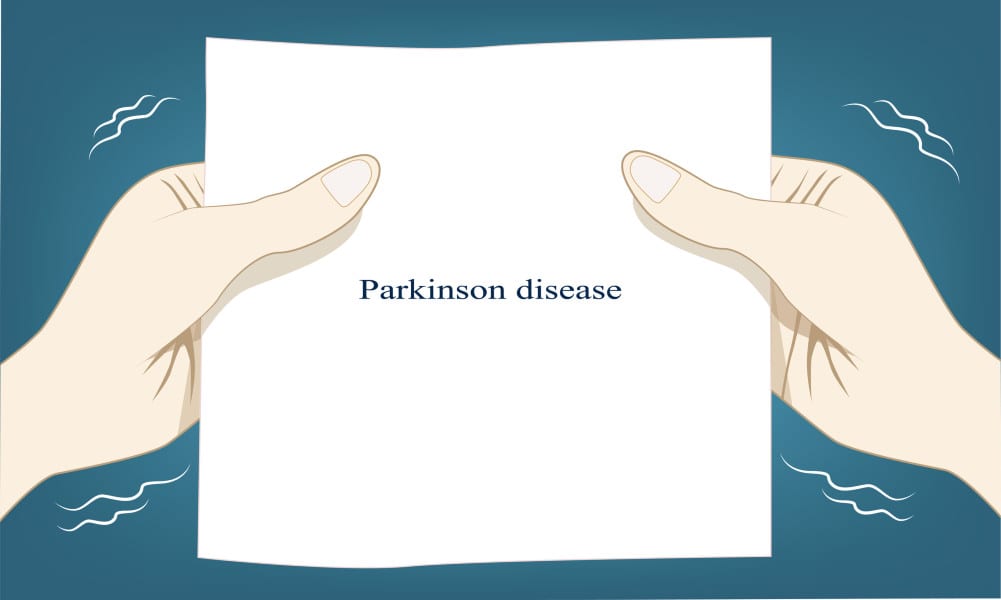 New Approach to Evaluate Parkinson’s Tremor Severity Involves Machine Learning
